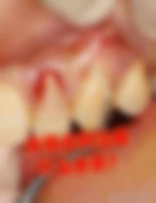 【王早堂医生擅长项目】