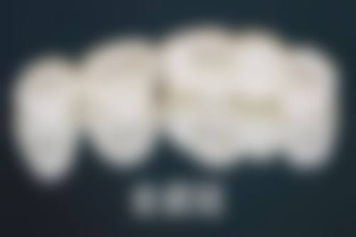 做的烤瓷牙可以矫正吗？了解矫正可行性、过程及注意事项，助你轻松重拾整齐美牙！ 