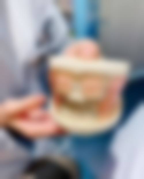 【上海宝山区王延萍口腔特色项目:】