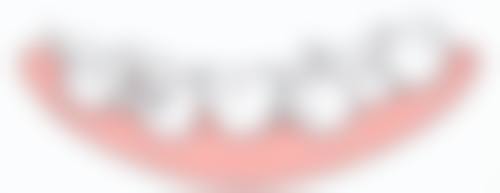 种植体基台牙冠