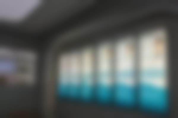 深圳横岗格伦菲尔口腔丁霞医生德国歌兰迪欧树脂补牙实例/口碑