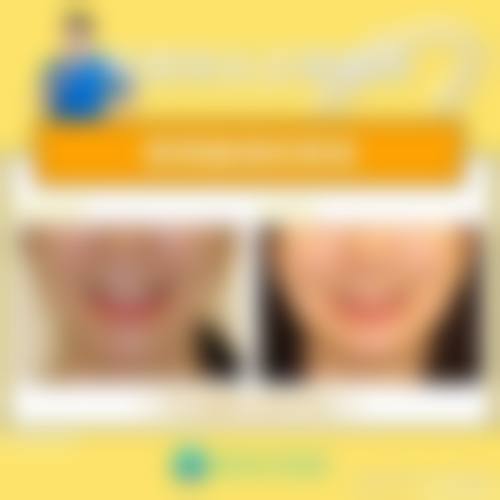 【佳美口腔医院(国贸门诊)是正规的吗?】