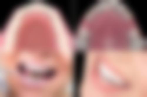 【上海嘉贝尔口腔门诊部特色项目:】