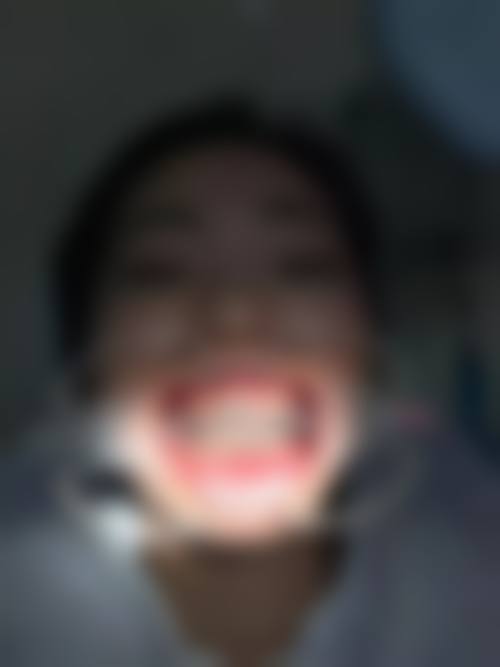 【深圳慈恩口腔患者口碑评价:】