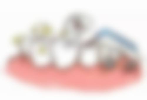 为什么会老掉牙,主要病因是什么,有哪些预防方法