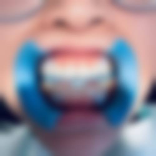 【河北唐山迁安乐康口腔特色项目:】