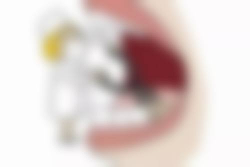 45岁牙齿矫正会不会有后遗症或危害?对身体有影响吗?