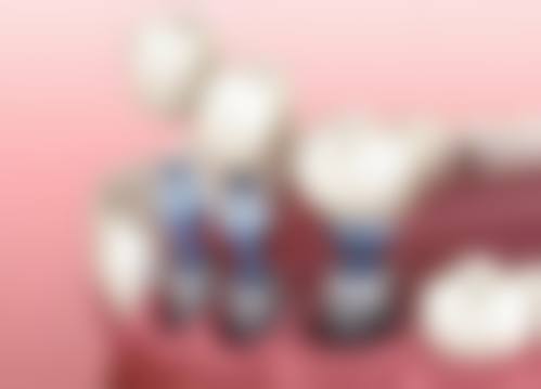 【徐丹丹医生技术特点】
