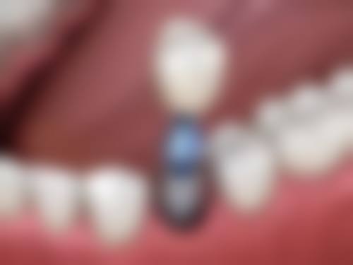 【徐钟镇医生荣誉资质】