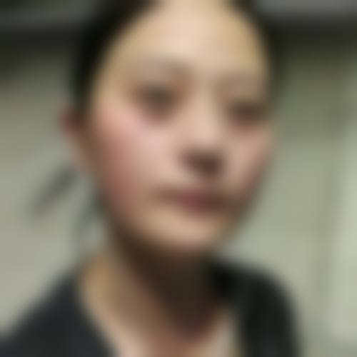 大冶市人民医院眼科就诊流程与服务说明