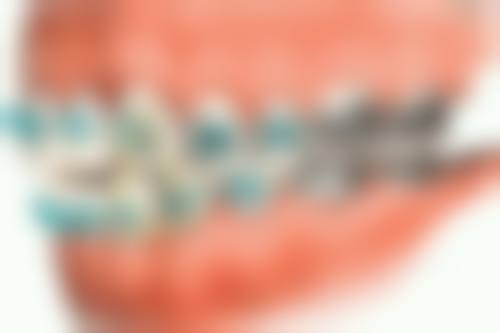 【高密王志口腔门诊部参考价格表：】