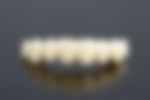 孩子牙齿早期矫正特别重要 越早治疗越好 如果按年龄划分 可分为三个阶段