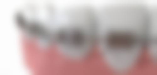 【扬州仪征雅贝佳口腔诊所是正规的吗?】