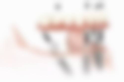 拔了智齿后悔死了 四种情况是不需要拔智齿的