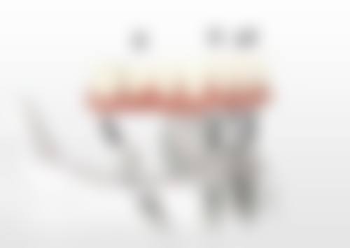 韩国奥齿泰种植体项目的技术优势