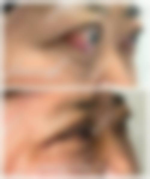 大连大学附属新华医院眼科重点科室与诊疗项目介绍