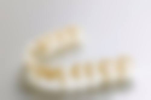 昆明昆安口腔国产爱尔创牙冠 1280 元起的技术优势