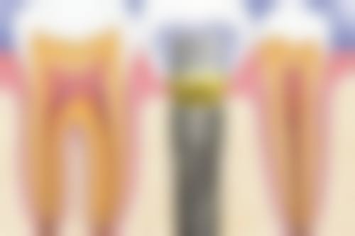 【刘严键医生擅长项目:】