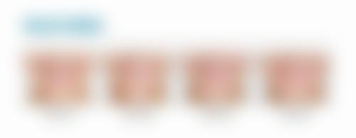 透明收费与优惠活动:高性价比让您无忧看牙