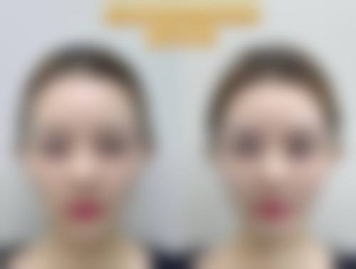 总结与预约号召