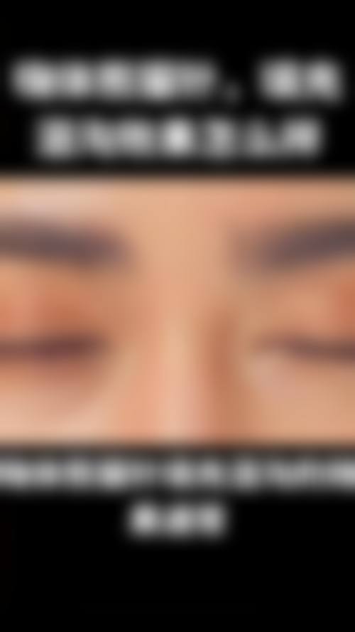 临床实例分享