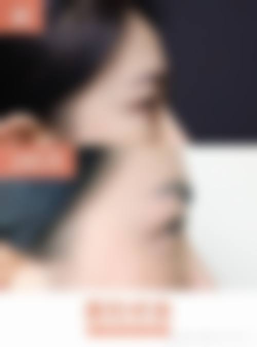 预约优惠活动:现在预约有什么优惠吗?