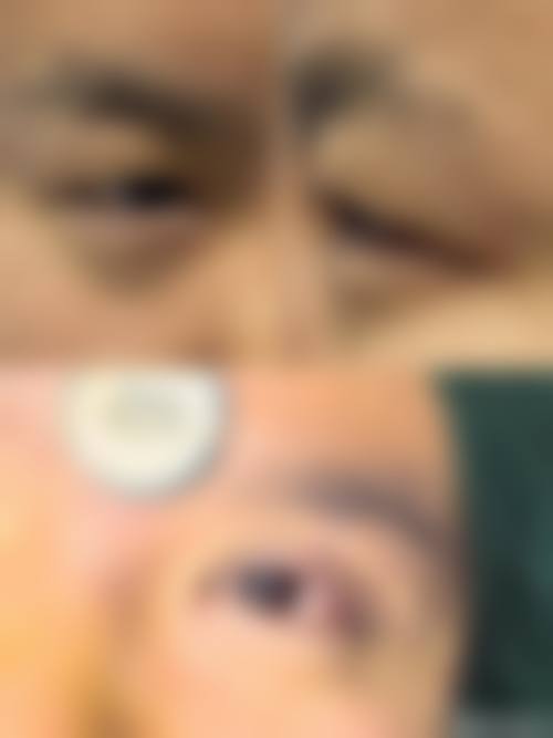结尾预约号召:立即行动,焕新双眸