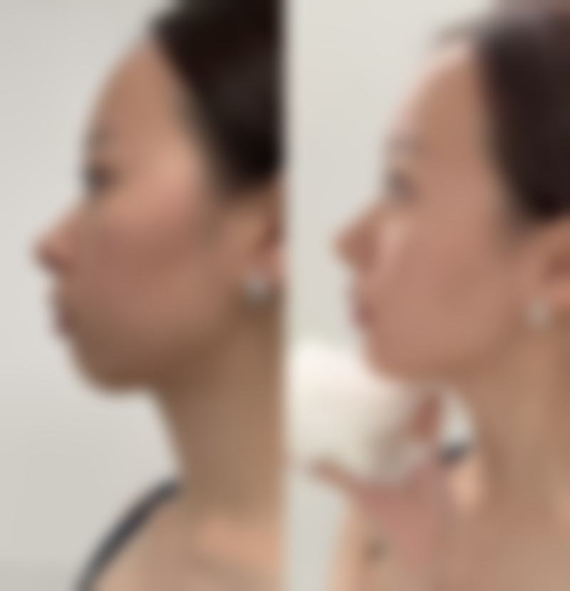 结尾预约号召