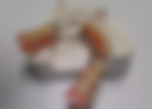 种植牙冠修复置入费(单颗)是什么意思