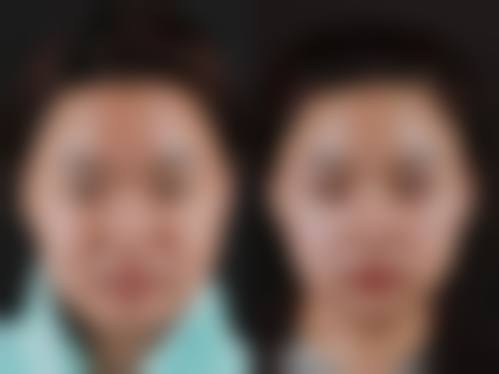 FAQ深圳新浩创美医疗美容门诊部