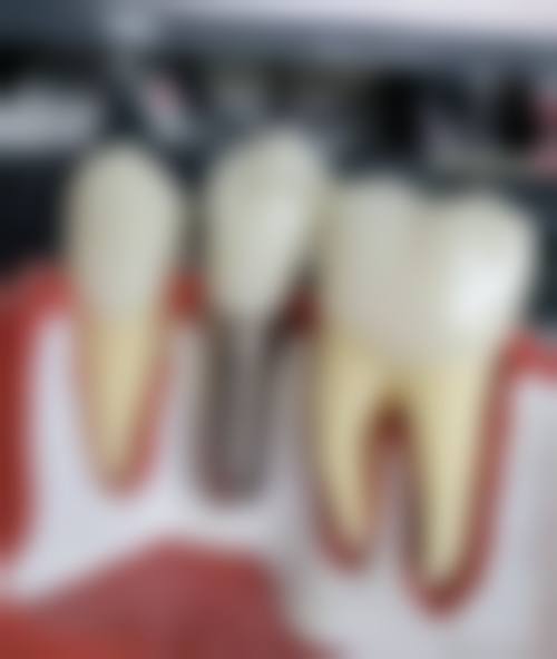 擅长项目详解:全方面覆盖主流矫正技术