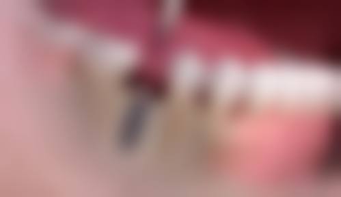 预约优惠活动:有没有隐藏限制?
