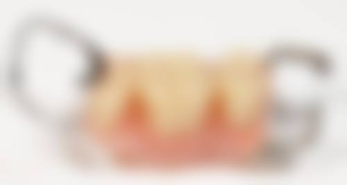 临床实例分享:治疗成效因人而异?