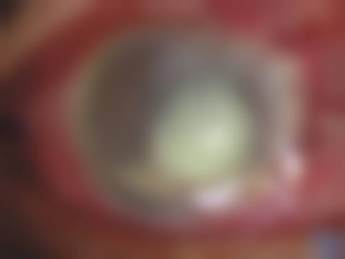 预约优惠活动:便捷通道助力就医
