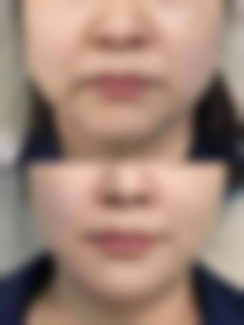 精良设备与特色项目打造高端医美体验