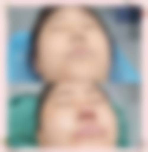 临床实例分享
