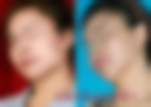 患者真实评价:口碑见证实力