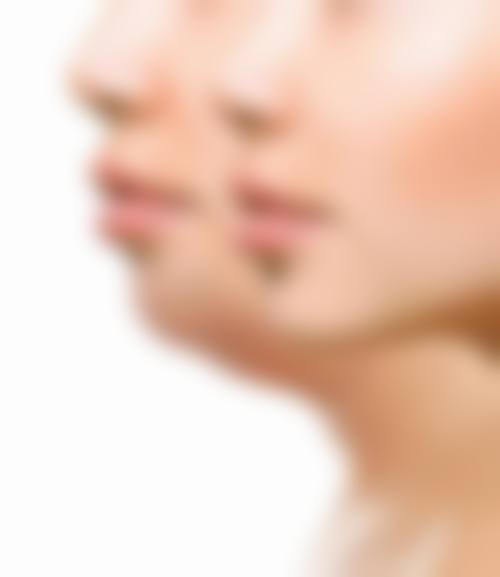 预约优惠活动:荆州青逸美植发医疗美容门诊