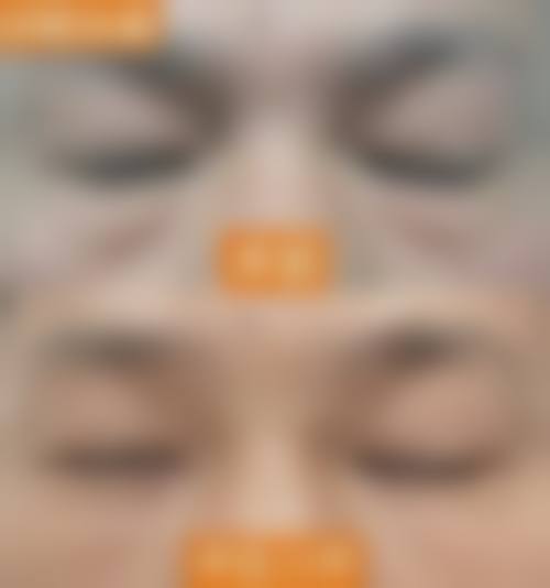 擅长项目详解:荆州青逸美植发医疗美容门诊