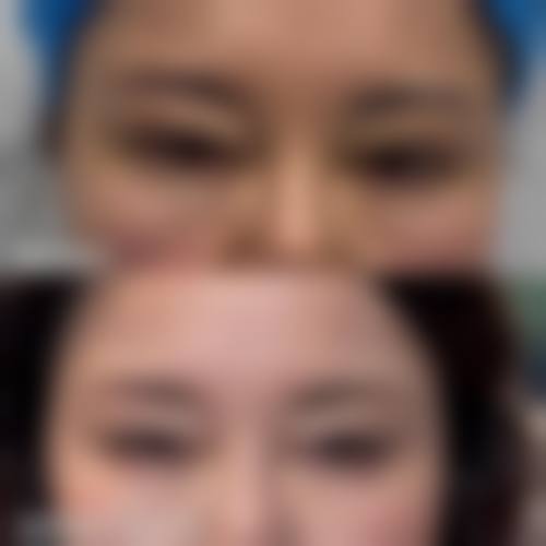 擅长项目详解:宁波宁海第一医院医疗美容科地区+领域+医生推荐