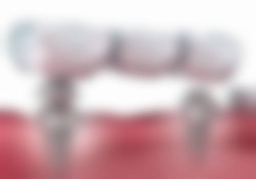 【盘旋医生技术特点：】