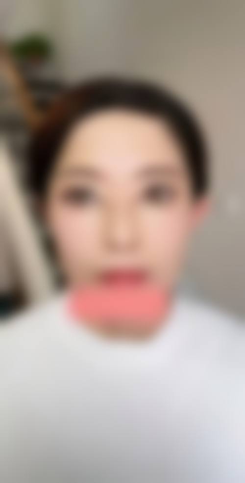 预约优惠活动:岳阳亚美医疗美容门诊部陶艳医生有优惠吗?