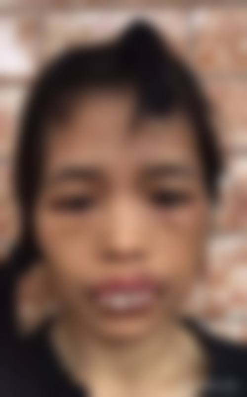 擅长项目详解:昆明拜博口腔医院肖化云