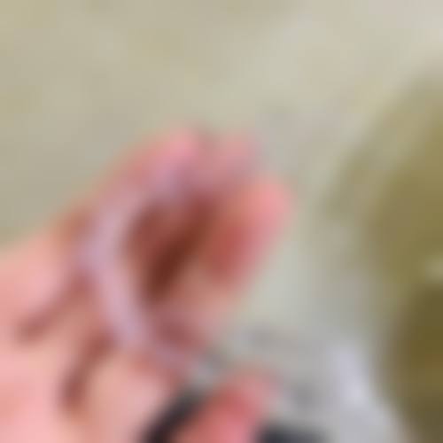 价格透明无隐形消费,惠民优惠助力看牙