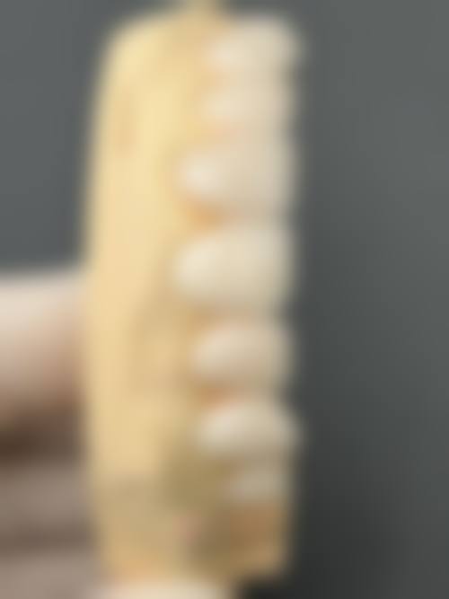 FAQ:昆明拜博口腔医院肖化云