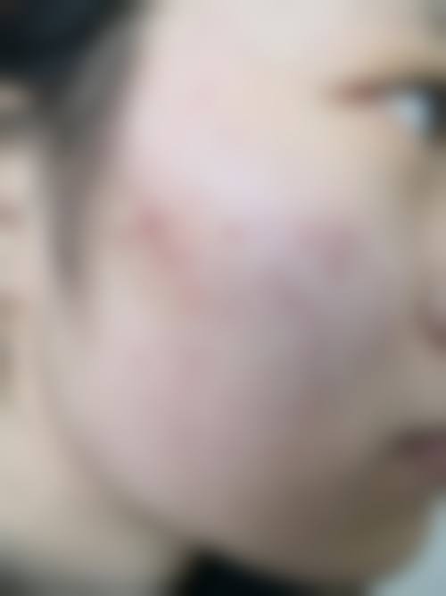 预约优惠活动
