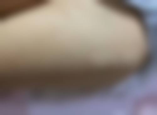 临床实例分享