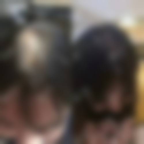 临床实例分享:岳阳亚美医疗美容门诊部陶艳医生真实成效如何?