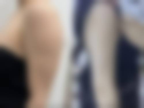 患者真实评价:上海澳雅医疗美容门诊部张枫