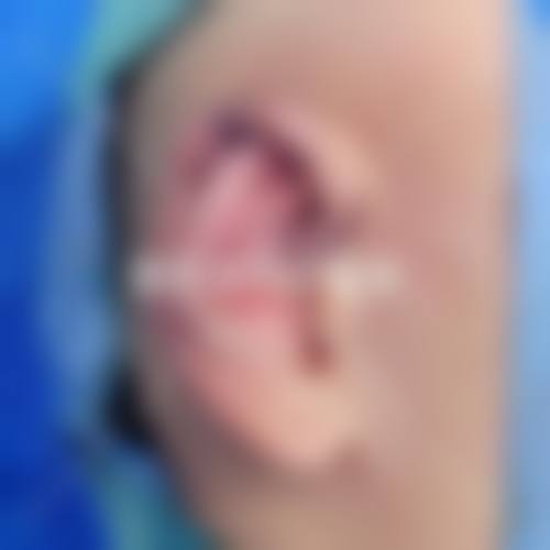 医生资质介绍:上海澳雅医疗美容门诊部张枫
